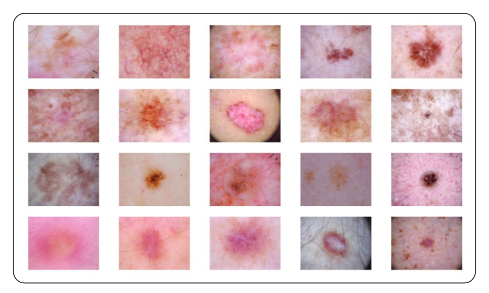 Dermatology