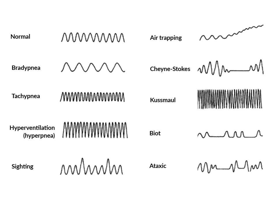 Figure-2b_for_Article_health_monitoring_by_RF