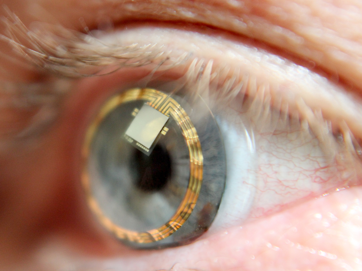 Sensimed-TF-Horus-on--eye