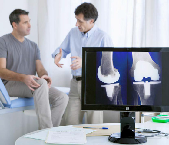 Additive Manufacturing for Personalized Knee Systems