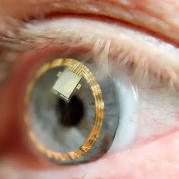 sensimed_tf_horus_on_eye-medium